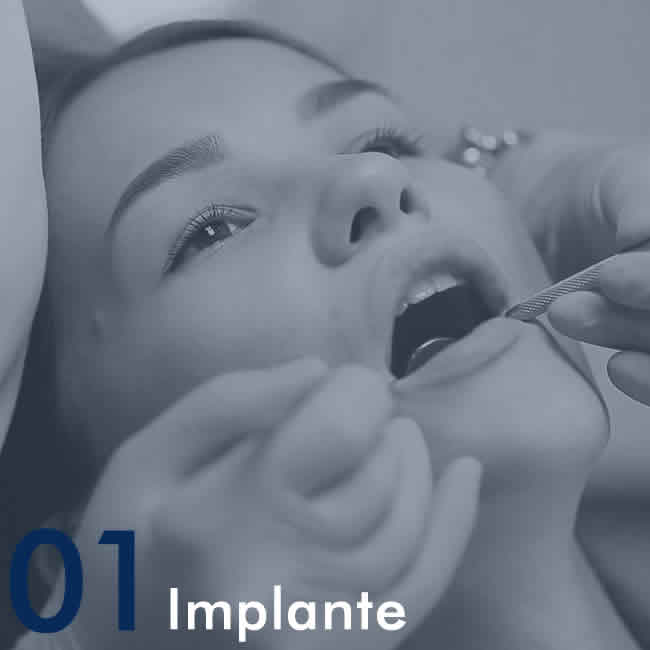 Implante