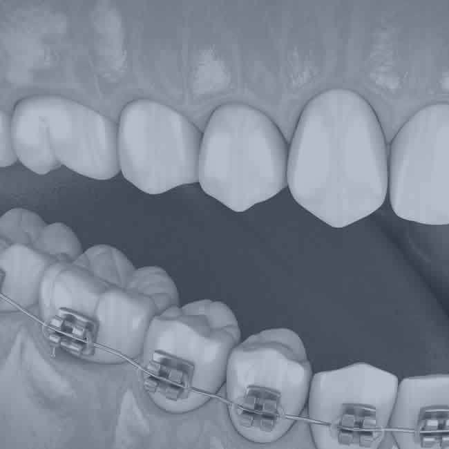 Ortodontia Ortodontia